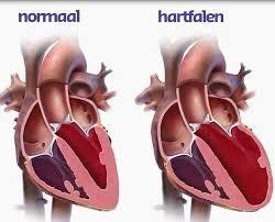 Hartfalenverpleegkundige, Een Job Mét Een Hart Voor Het Hart | OLV ...