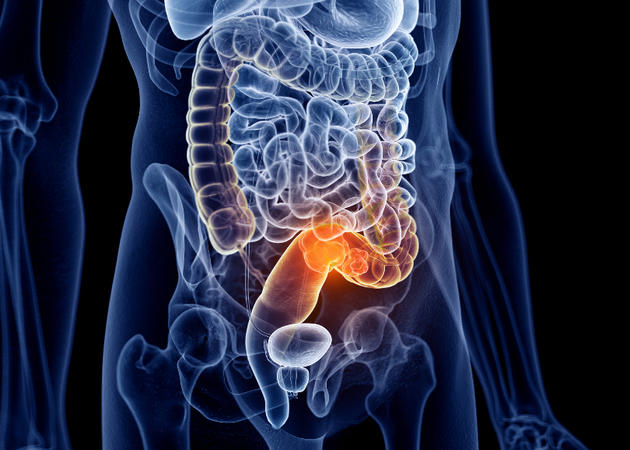 Digestieve oncologie - tumoren maag darm lever pancreas